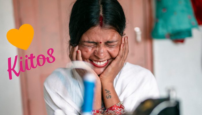 Nainen nauraa kädet poskillaan.